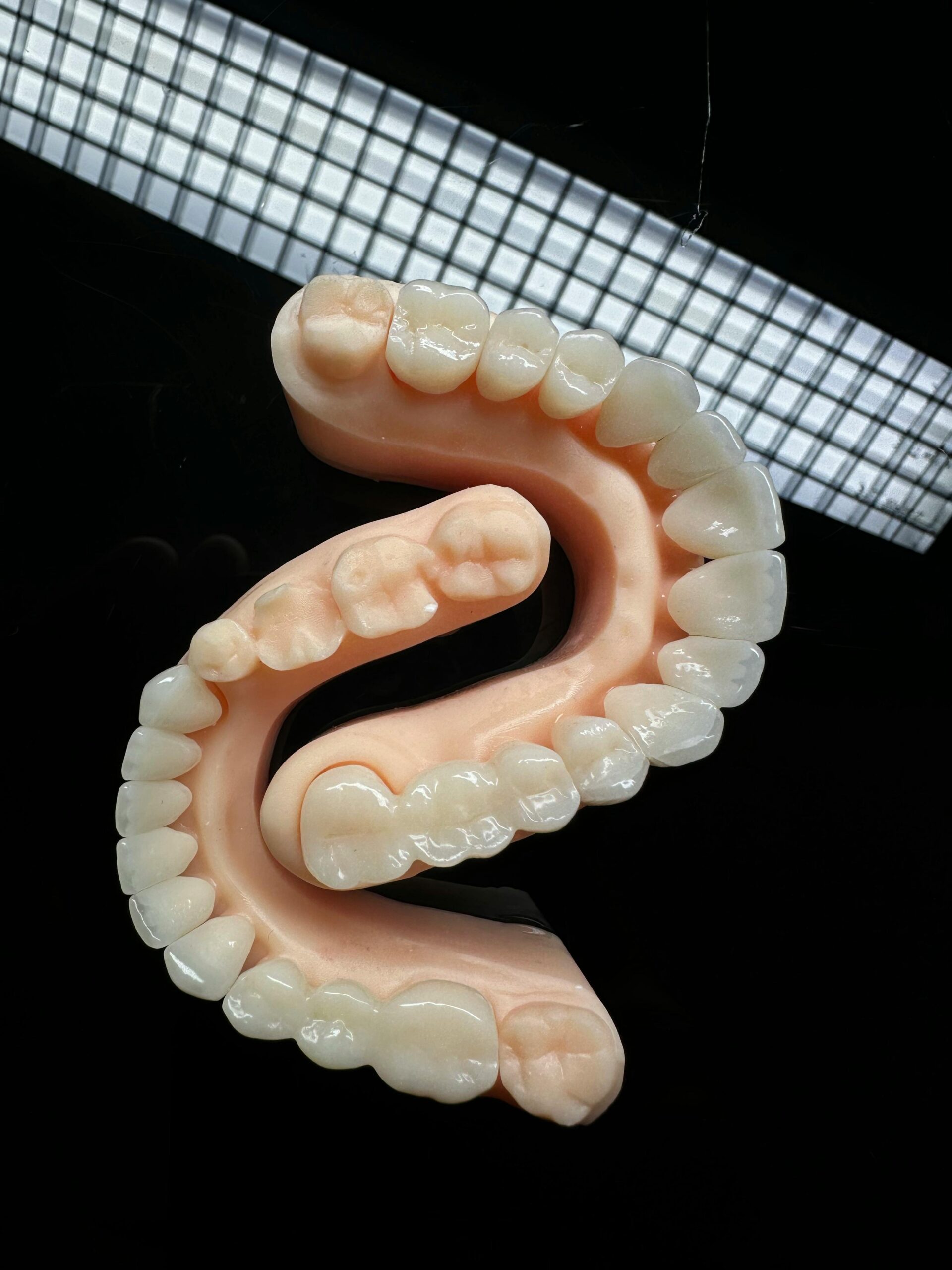 3 Close-up view of a dental mold showcasing teeth arrangement on a black backdrop.